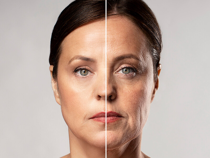 harmonização facial