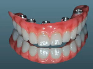 próteses dentárias